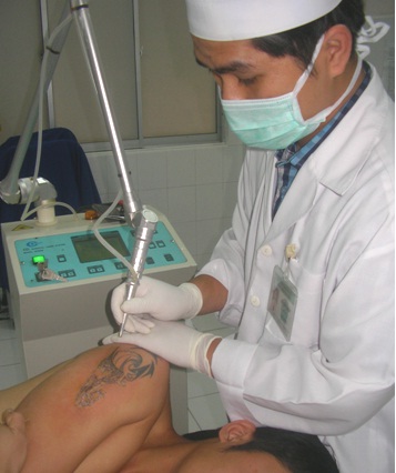Hình nhỏ