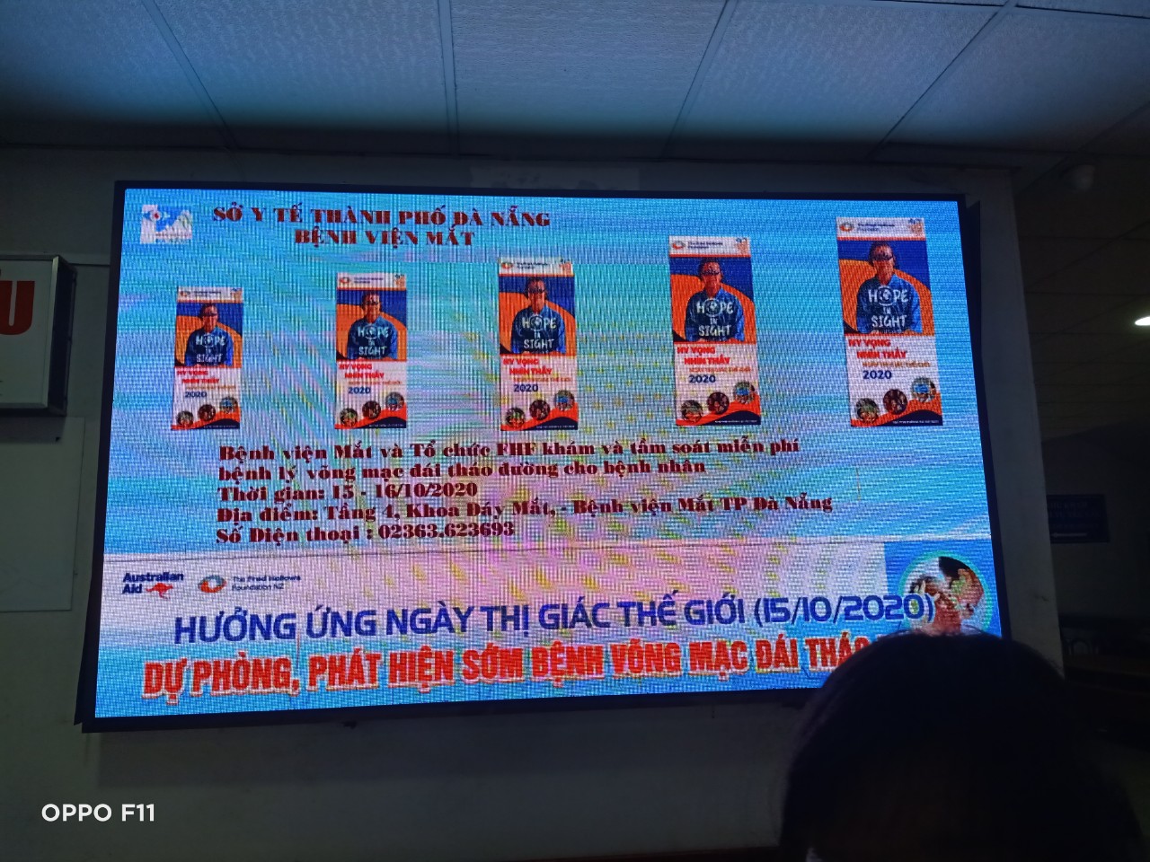 Hình nhỏ